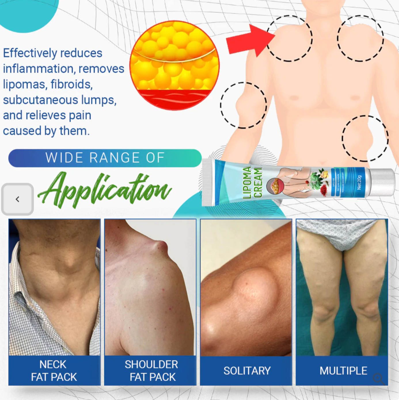 LumpFree™ Lipoma Removal Cream